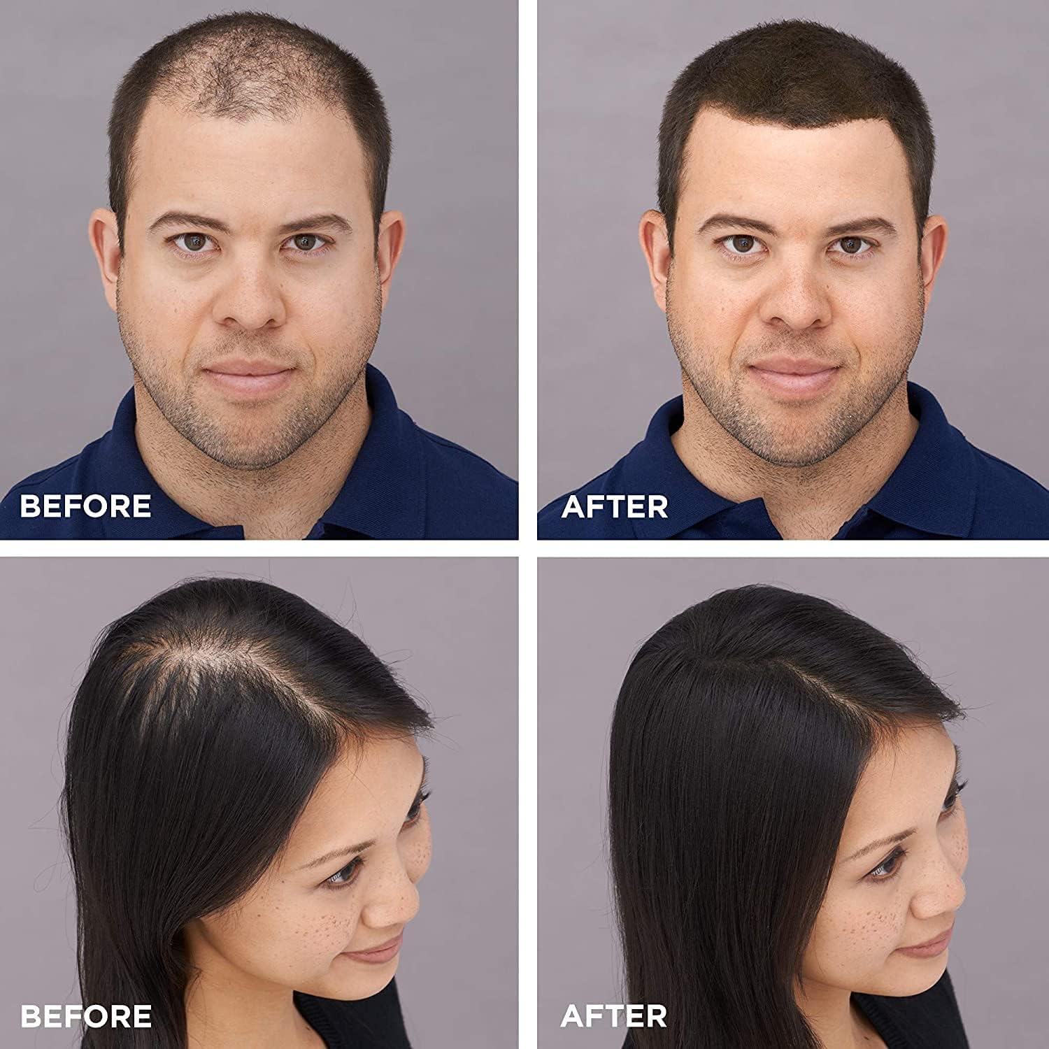 Toppik Hair